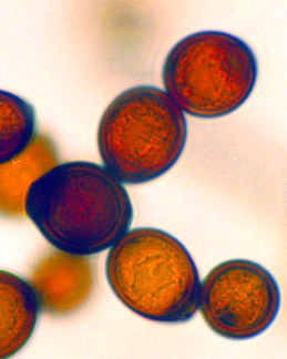 Podaxis pistillaris