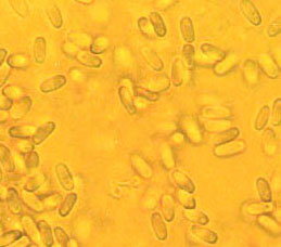 Protubera jamaicensis