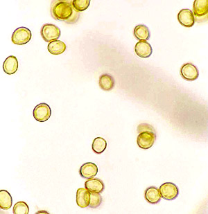 Protubera clathroidea