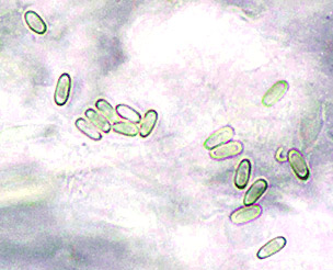 Protubera sabulanensis