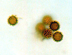 Radiigera fuscogleba