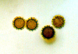 Radiigera fuscogleba