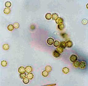 Radiigera taylorii