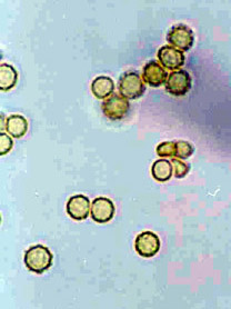Radiigera taylorii