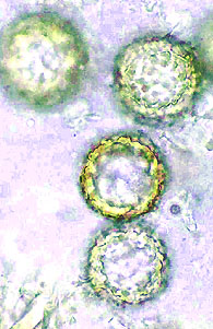 Reddellomyces westraliensis