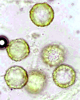 Reddellomyces westraliensis