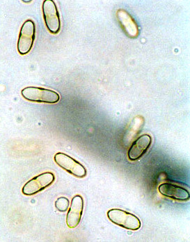 Rhizopogon brunneicolor