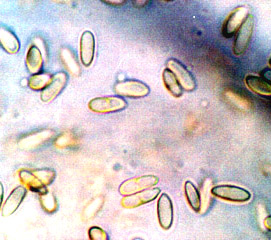 Rhizopogon parksii