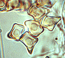 Richoniella asterosporus
