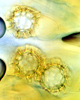 Ruhlandiella berolinensis