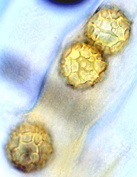 Ruhlandiella berolinensis