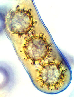 Ruhlandiella berolinensis