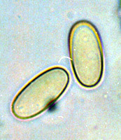 Sarcosphaera coronaria