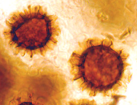 Scleroderma hypogaeum 