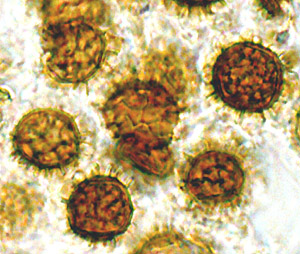Scleroderma hypogaeum 