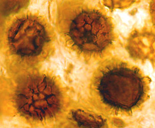 Scleroderma hypogaeum