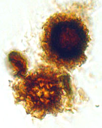Scleroderma sp. nov.