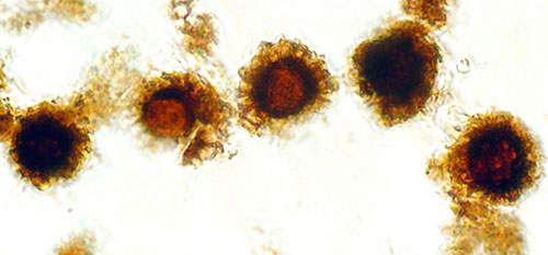 Scleroderma sp. nov.