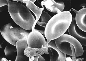 Sedecula pulvinata