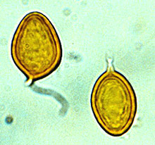 Sedecula pulvinata