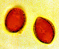 Setchelliogaster tenuipes