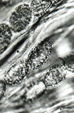 Sphaerozone ellipsosporum