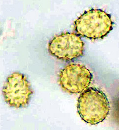 Stephanospora sp.