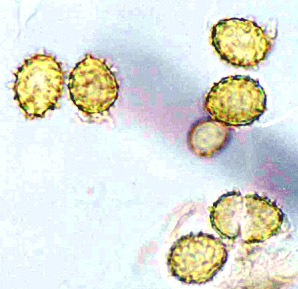 Stephanospora sp.