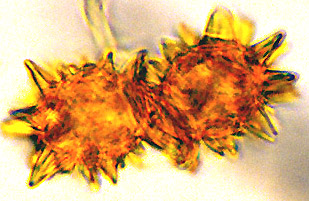 Stephanospora megaspina
