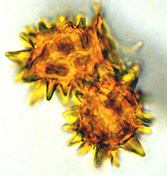 Stephanospora megaspina
