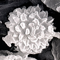 Terfezia spinosa
