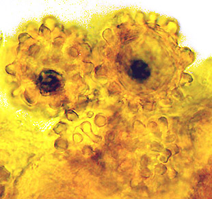 Terfezia arenaria