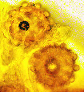 Terfezia arenaria