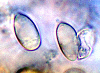 Torrendia pulchella