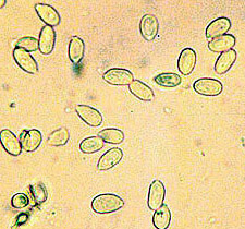 Trappea sp.