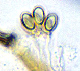 Trappea darkeri