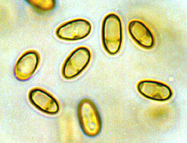 Truncocolumella citrina