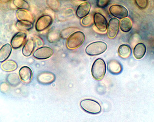 Truncocolumella citrina