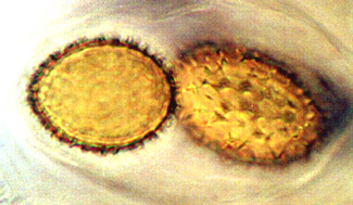 Tuber lyonii