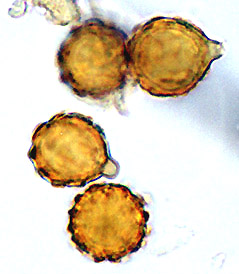 Wakefieldia macrospora