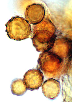 Wakefieldia macrospora