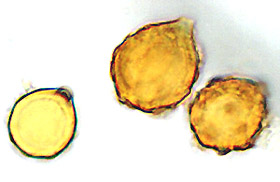 Wakefieldia macrospora