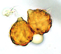 Wakefieldia macrospora