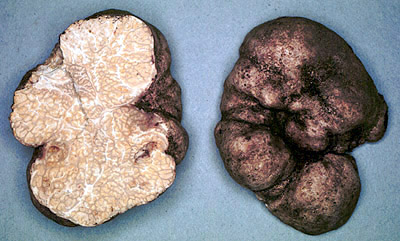 Choiromyces alveolatus 