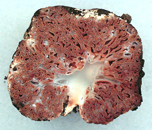 Gautieria gautierioides 