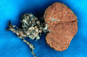 Gautieria monticola 