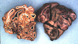 Hydnotrya cubispora