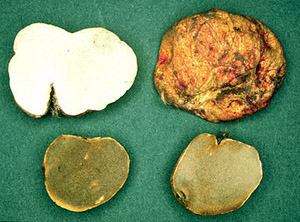 Rhizopogon occidentalis