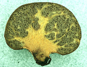 Truncocolumella citrina