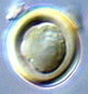 Carbomyces spore
